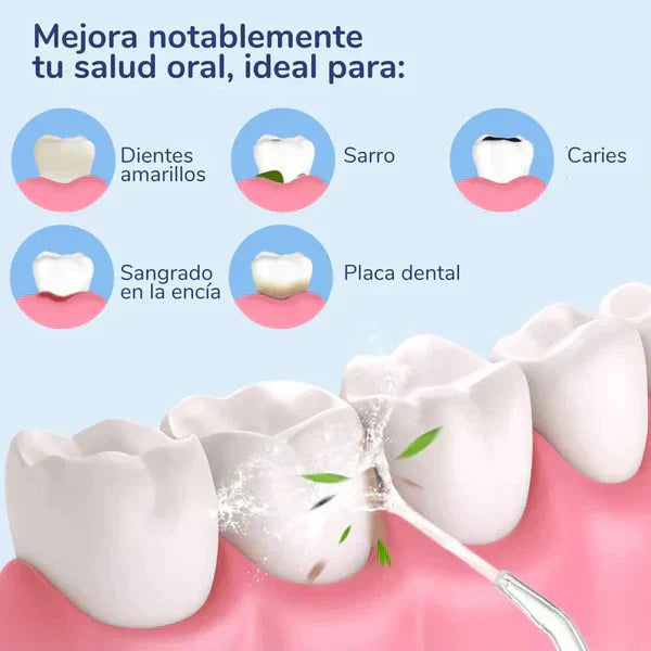 La Solución para una Higiene Bucal Completa: TU IRRIGADOR DENTAL PORTATIL +ENVIO GRATIS A TODO GUATEMALA