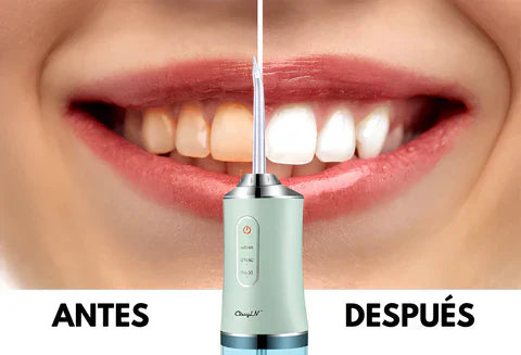 La Solución para una Higiene Bucal Completa: TU IRRIGADOR DENTAL PORTATIL +ENVIO GRATIS A TODO GUATEMALA